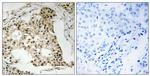 Phospho-RARA (Ser77) Antibody in Immunohistochemistry (Paraffin) (IHC (P))