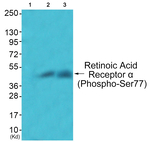 Phospho-RARA (Ser77) Antibody in Western Blot (WB)