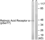 Phospho-RARA (Ser77) Antibody in Western Blot (WB)