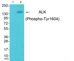 Phospho-ALK (Tyr1604) Antibody in Western Blot (WB)