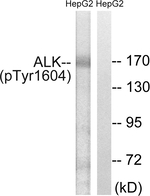 Phospho-ALK (Tyr1604) Antibody in Western Blot (WB)