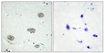Phospho-CSF1R (Tyr809) Polyclonal Antibody