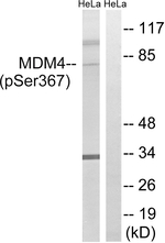 Phospho-MDMX (Ser367) Antibody in Western Blot (WB)