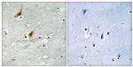 Phospho-MSK2 (Thr568) Polyclonal Antibody