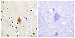 Phospho-MST1 (STK4) (Thr183) Antibody in Immunohistochemistry (Paraffin) (IHC (P))