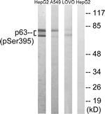 Phospho-p63 (Ser395) Antibody in Western Blot (WB)