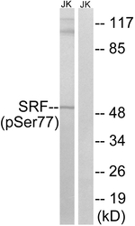 Phospho-SRF (Ser77) Antibody in Western Blot (WB)