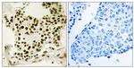 Phospho-UBF-1 (Ser484) Polyclonal Antibody