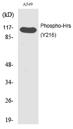 Phospho-HGS (Tyr216) Polyclonal Antibody