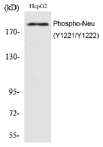 Phospho-ErbB2 (HER-2) (Tyr1221, Tyr1222) Antibody in Western Blot (WB)