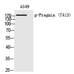 Phospho-SGK223 (Tyr413) Polyclonal Antibody