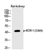 Phospho-OPRK1 (Ser369) Antibody in Western Blot (WB)