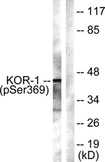 Phospho-OPRK1 (Ser369) Antibody in Western Blot (WB)