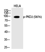 Phospho-PRKD2 (Ser876) Antibody in Western Blot (WB)