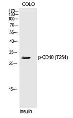 Phospho-CD40 (Thr254) Antibody in Western Blot (WB)