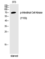 Phospho-ICK (Tyr159) Polyclonal Antibody