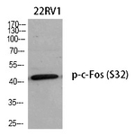 Phospho-c-Fos (Ser32) Antibody in Western Blot (WB)