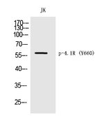 Phospho-EPB41 (Tyr660) Antibody in Western Blot (WB)