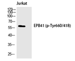 Phospho-EPB41 (Tyr660) Polyclonal Antibody