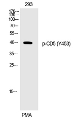 Phospho-CD5 (Tyr453) Antibody in Western Blot (WB)