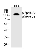 Phospho-EphB1/EphB2 (Tyr594, Tyr604) Antibody in Western Blot (WB)