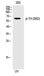 Phospho-Tyrosine Hydroxylase (Ser62) Polyclonal Antibody