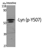 Phospho-Lyn (Tyr508) Polyclonal Antibody