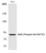 Phospho-STAT5 alpha/beta (Ser726, Ser731) Antibody in Western Blot (WB)