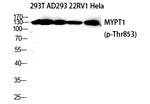 Phospho-MYPT1 (Thr853) Antibody in Western Blot (WB)