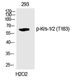 Phospho-MST1/MST2 (Thr183) Polyclonal Antibody