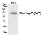 Phospho-p63 (Ser455) Antibody in Western Blot (WB)