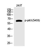 Phospho-p63 (Ser455) Antibody in Western Blot (WB)