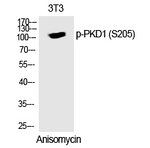 Phospho-PKC mu (Ser205) Polyclonal Antibody