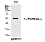 Phospho-Vimentin (Ser83) Polyclonal Antibody