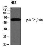 Phospho-NF2 (Ser10) Polyclonal Antibody