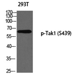 Phospho-TAK1 (Ser439) Polyclonal Antibody