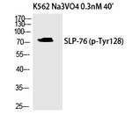 Phospho-SLP76 (Tyr128) Polyclonal Antibody