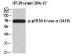 Phospho-p70 S6 Kinase (Ser418) Polyclonal Antibody