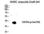 Phospho-CXCR4 (Ser339) Antibody in Western Blot (WB)