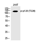 Phospho-delta Catenin (Tyr228) Antibody in Western Blot (WB)