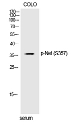Phospho-ELK3 (Ser357) Polyclonal Antibody