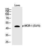 Phospho-OPRM1 (Ser375) Antibody in Western Blot (WB)