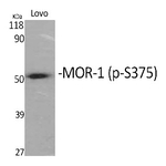 Phospho-OPRM1 (Ser375) Polyclonal Antibody