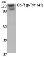 Phospho-Leptin Receptor (Tyr1141) Polyclonal Antibody