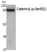 Phospho-beta Catenin (Ser552) Antibody in Western Blot (WB)