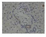 GLIS2 Polyclonal Antibody