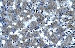 SPT3 Polyclonal Antibody