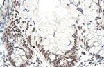 ZNF394 Polyclonal Antibody