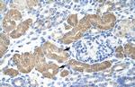 L3MBTL2 Polyclonal Antibody