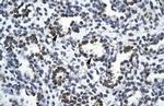 RBM10 Antibody in Immunohistochemistry (Paraffin) (IHC (P))